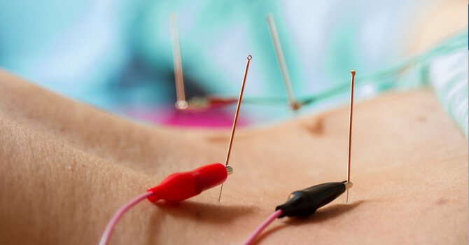 Medical Acupuncture