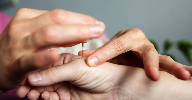 Traditional Chinese Medicine Acupuncture